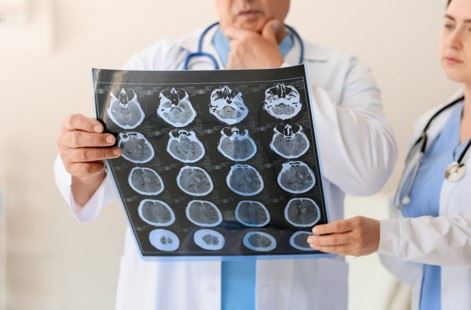 two doctors looking at an MRI brain scan